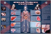 Электрифицированный стенд "Вредные привычки: алкоголизм" - fgospostavki.ru - Шумерля