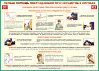 Таблица "Порядок действий при опасном кровотечении" (100х140 сантиметров, винил) - fgospostavki.ru - Шумерля
